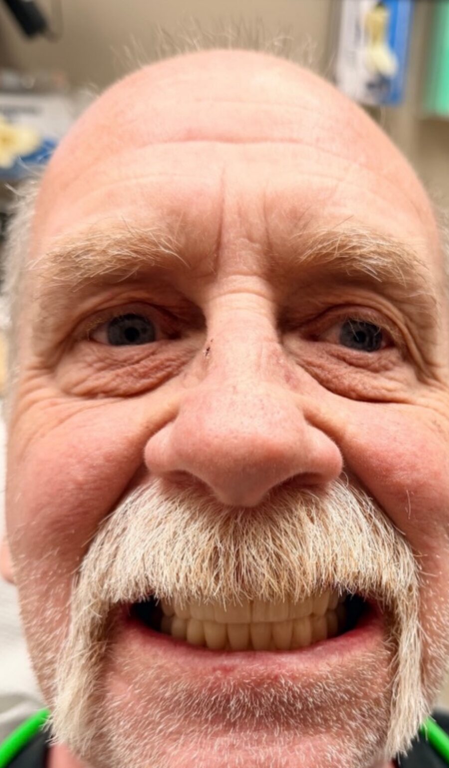David smiling after full mouth dental implants