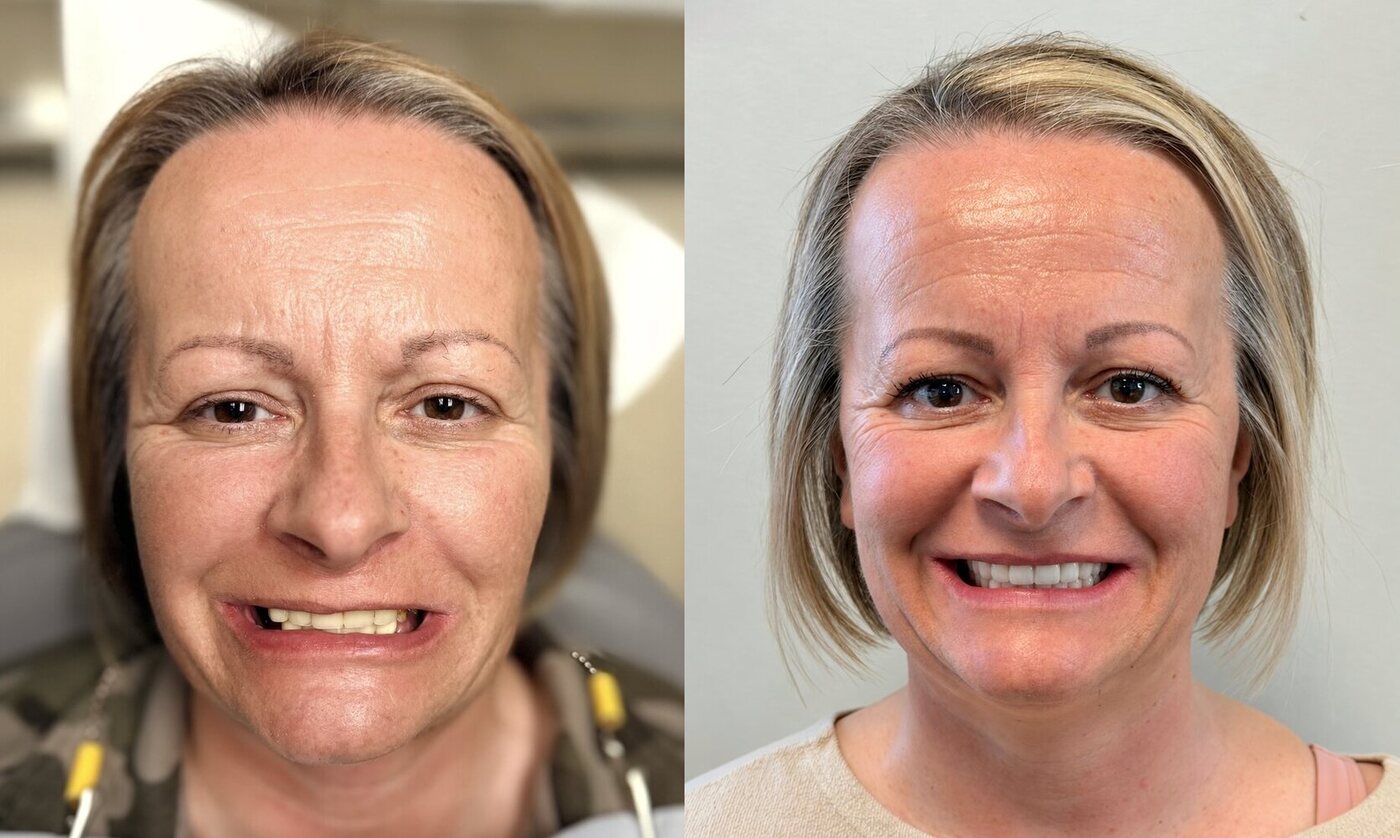 Dominika before and after